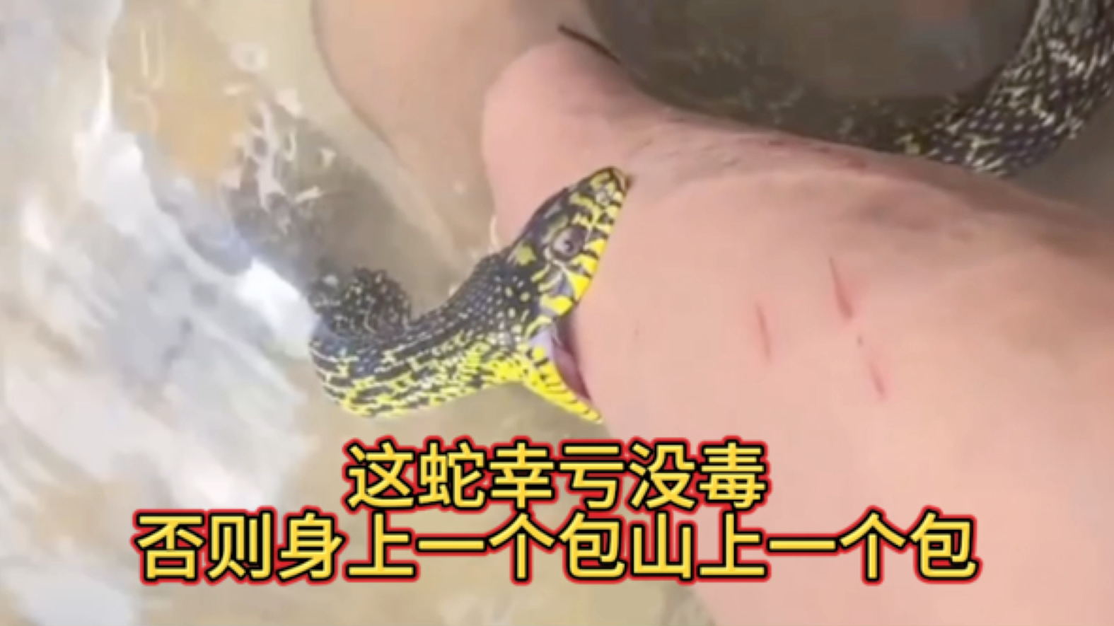 这蛇幸亏没毒,否则身上一个包山上一个包