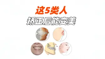 下载视频: 整牙后变化很大的5类人