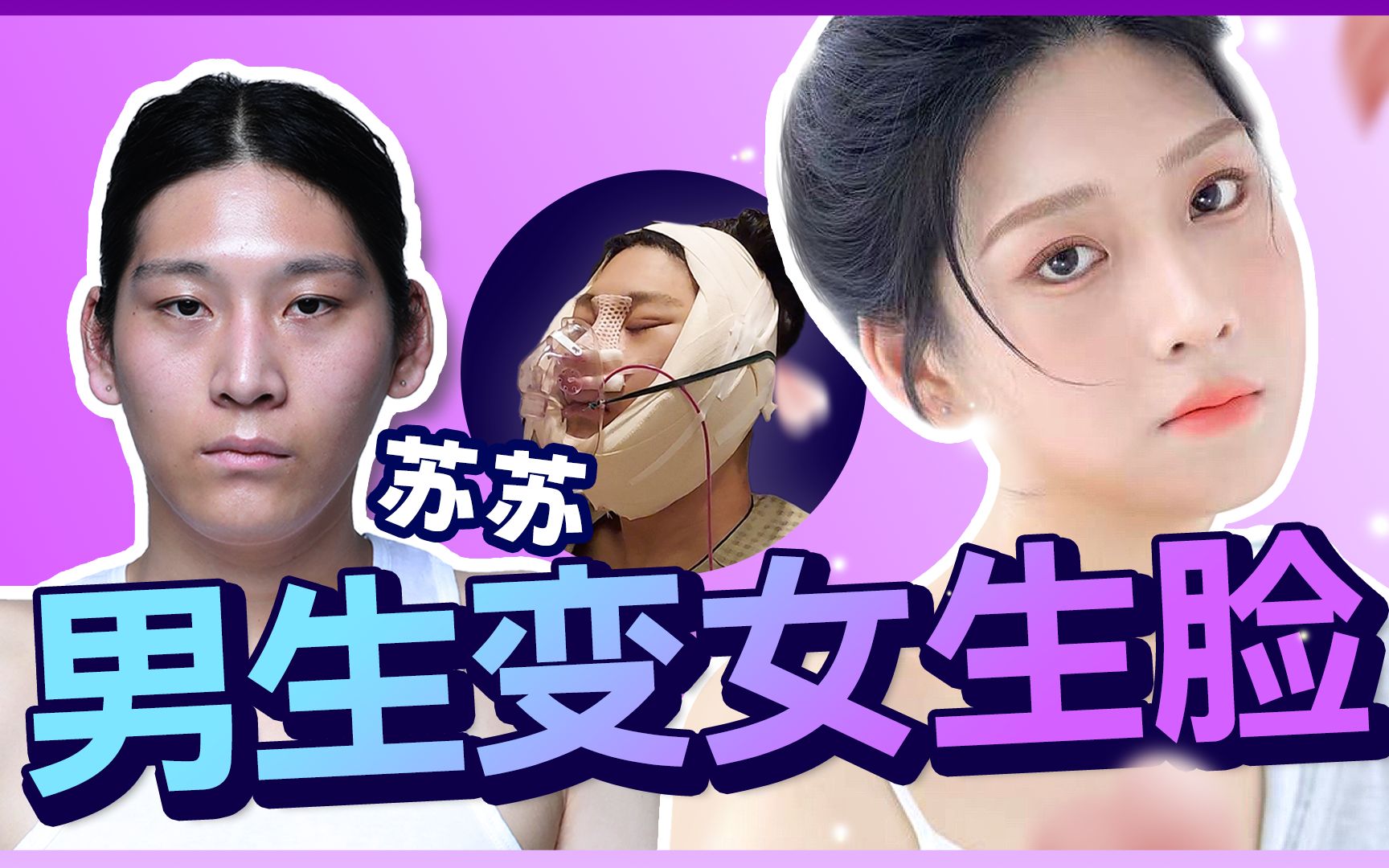 苏酥男生变女生脸整容记_第一集
