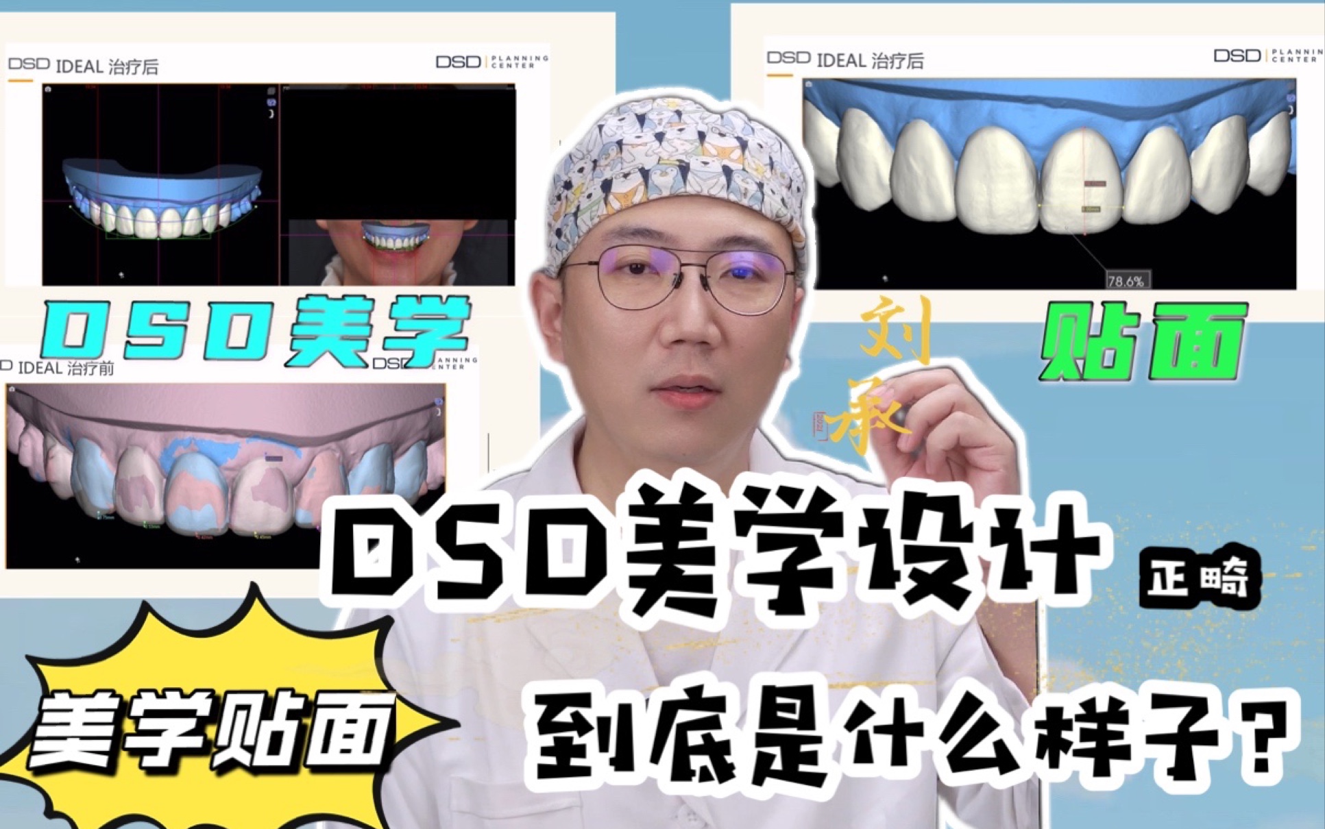 [图]DSD美学设计正畸到底是什么样子呢？