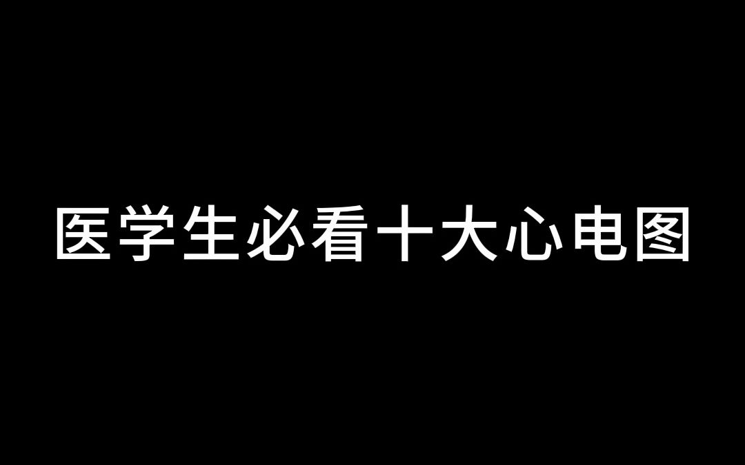 医学生必看十大心电图哔哩哔哩bilibili