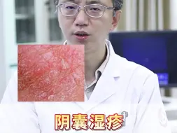 Tải video: 阴囊湿疹太尴尬，痒起来受不了，怎么对待效果好？