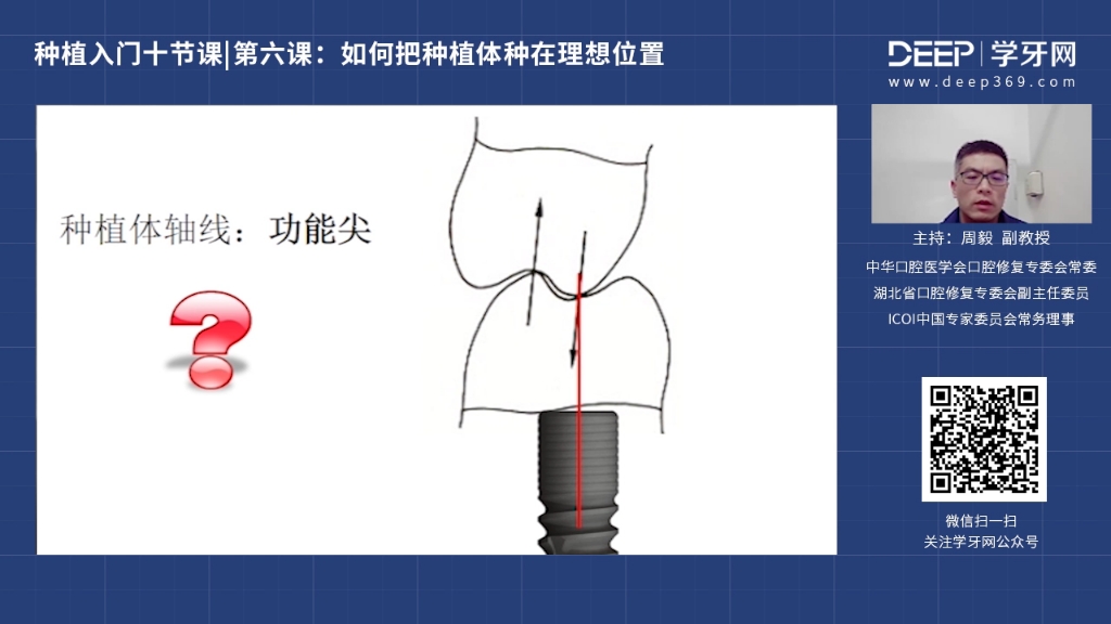 周毅种植入门十节课/如何把种植体种在理想位置哔哩哔哩bilibili