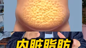 消除内脏脂肪