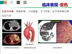 Tải video: 金 属 音 咳 嗽