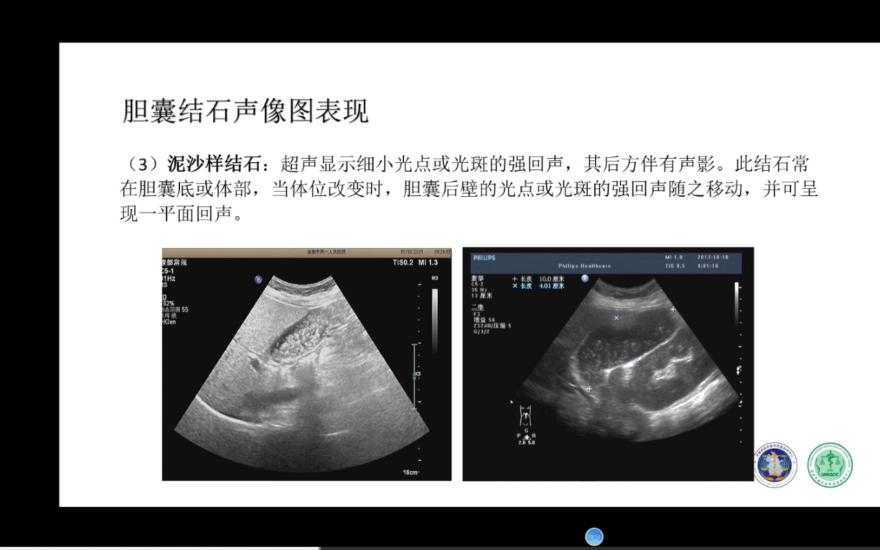 [图]搬运。胆囊常见疾病的超声诊断及报告书写规范段秉慧老师