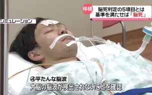 Video herunterladen: 日本脑死亡的判定标准