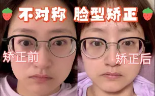 Tải video: 脸歪怎么办？下颌骨矫正，15天亲测有效，肉眼可见的端正起来~