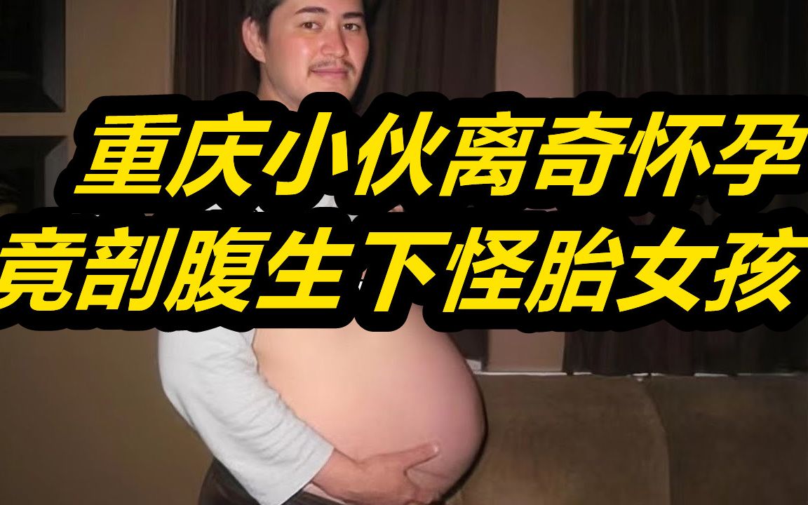 [图]重庆农村小伙离奇怀孕，竟刨腹生下「怪胎女孩」，医生看到后大呼惊奇！