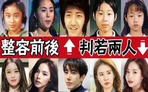 Download Video: 想红就得狠！凭整容逆天改命的明星们，洪真英整容前后不敢认，他整容前后差别大