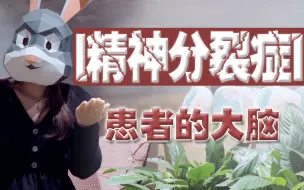 Tải video: 精神分裂症，分裂出的是什么？大脑为什么会产生妄想幻觉？