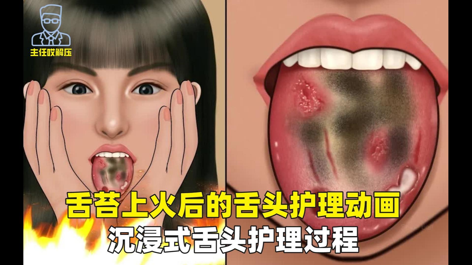 不锈钢舌苔清洁器舌苔刮除器刮舌舌苔板刮舌头除口臭口腔护理工具-阿里巴巴
