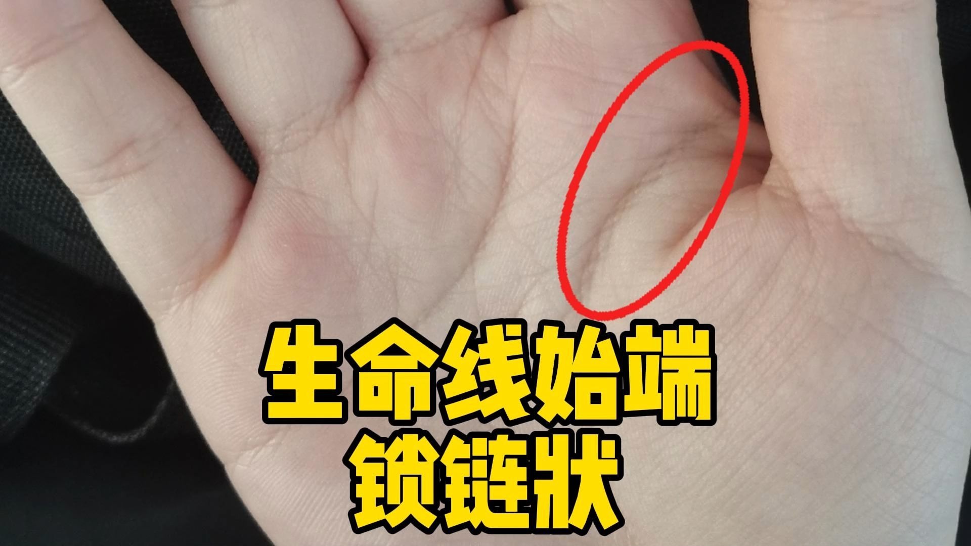 生命线始端锁链状!