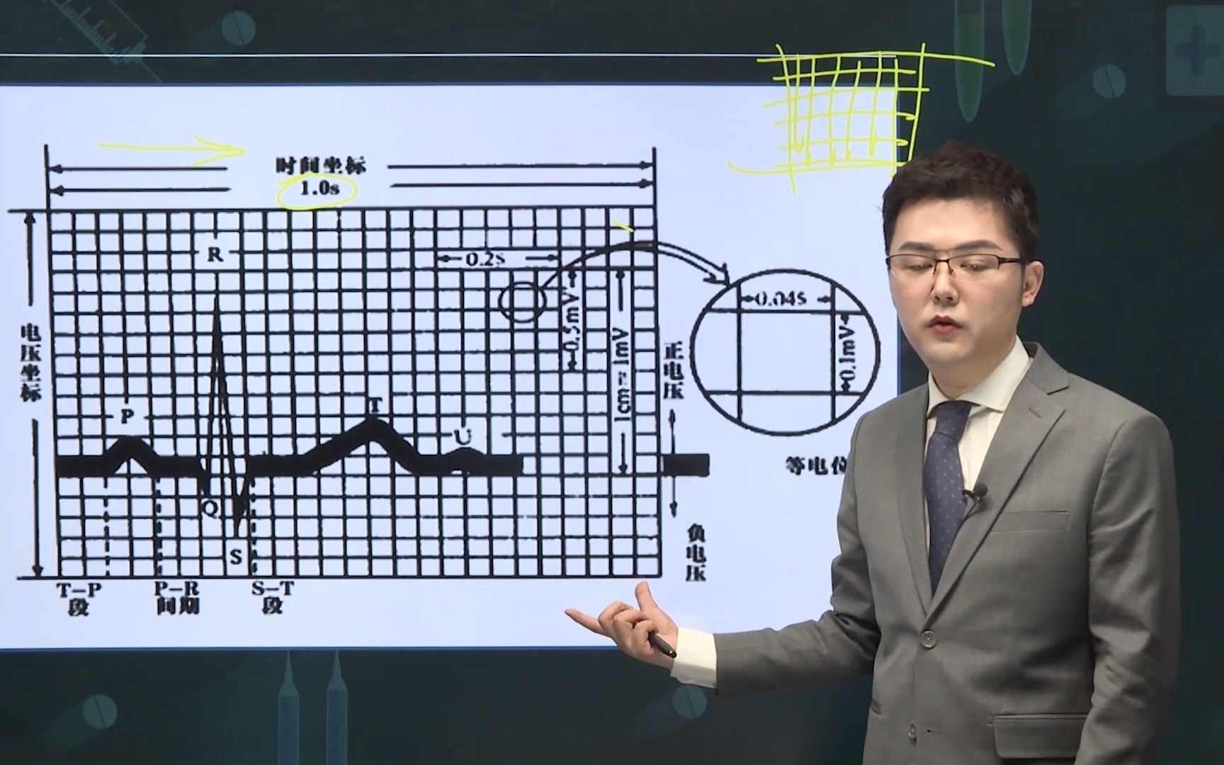心电图的结构,如何识别心电图?哔哩哔哩bilibili