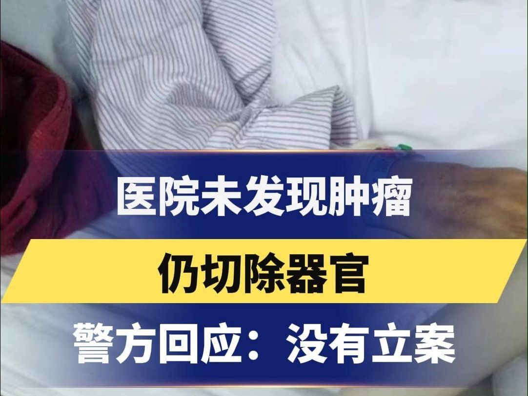 未发现肿瘤仍切除器官医院担全责 警方回应医院未发现肿瘤仍切除器官 没有立案 #立案 #医疗事故 #纠纷哔哩哔哩bilibili