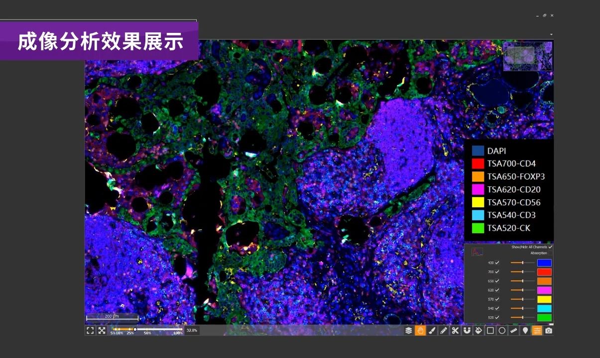 多重荧光免疫组化成像分析效果展示