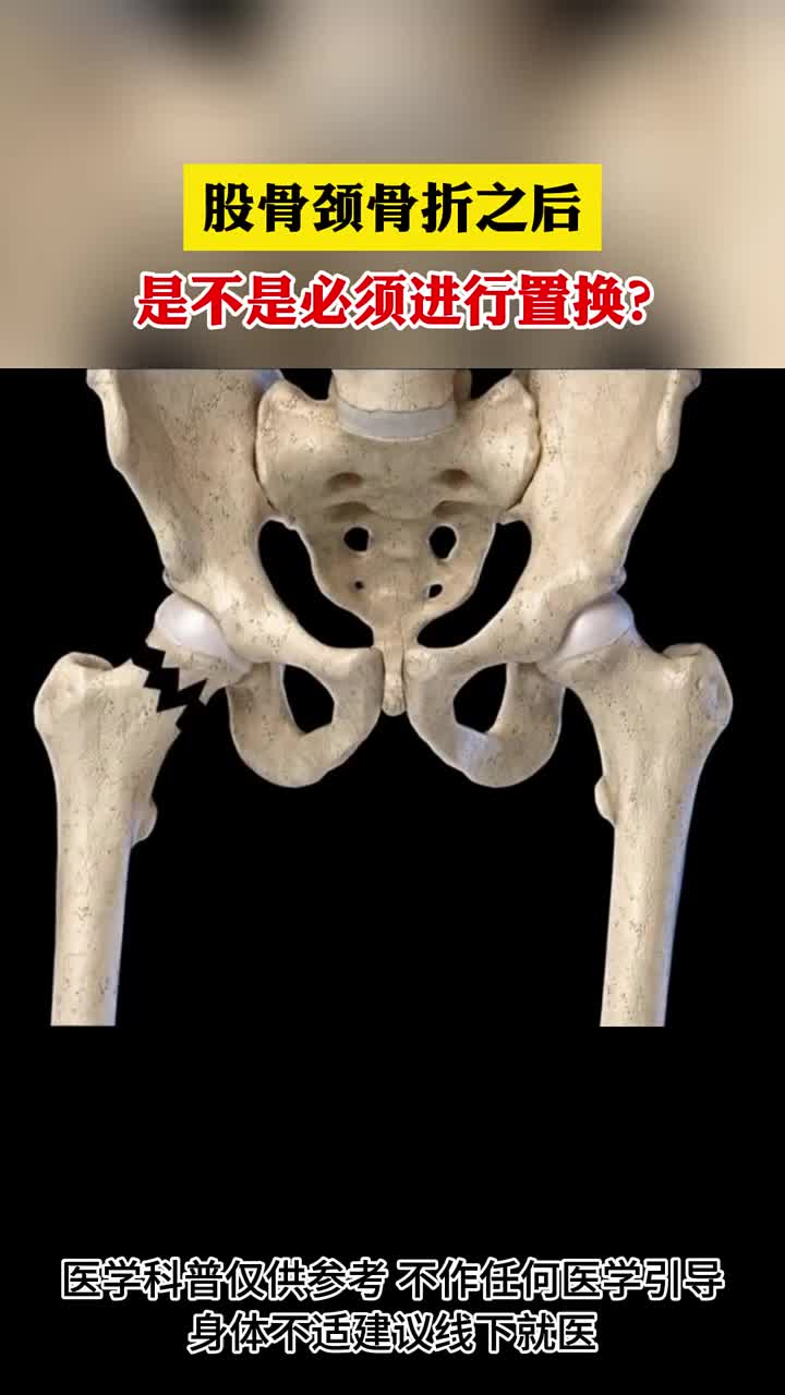 股骨颈骨折之后