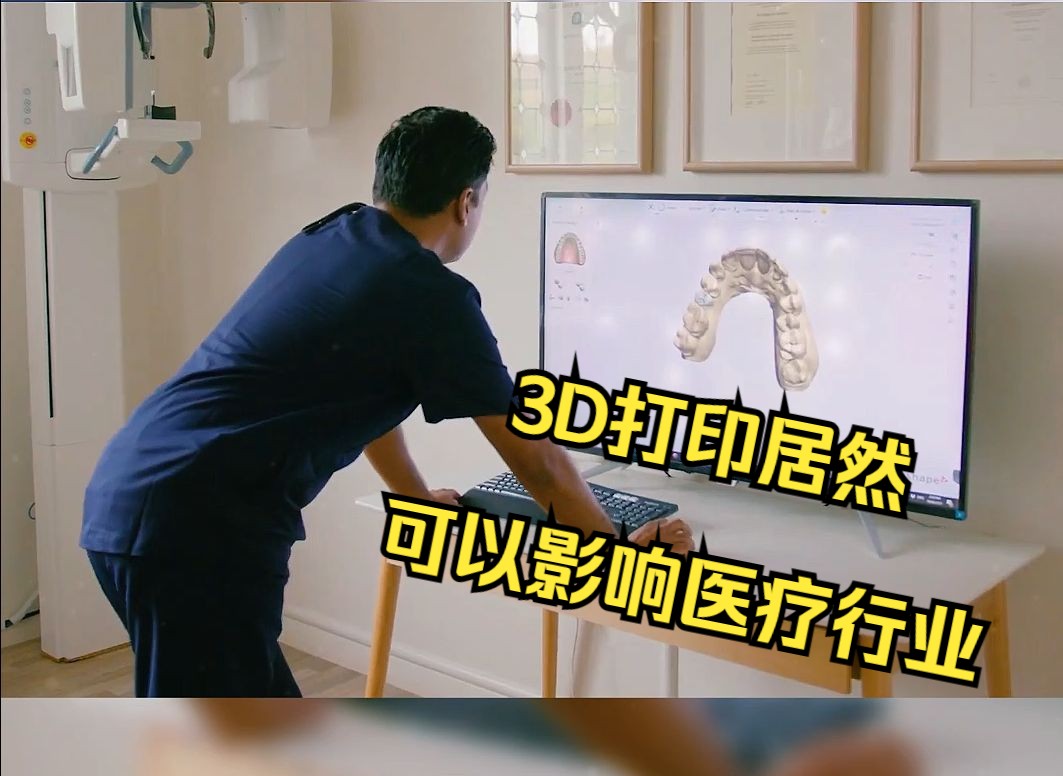 3D打印居然可以影响医疗行业哔哩哔哩bilibili