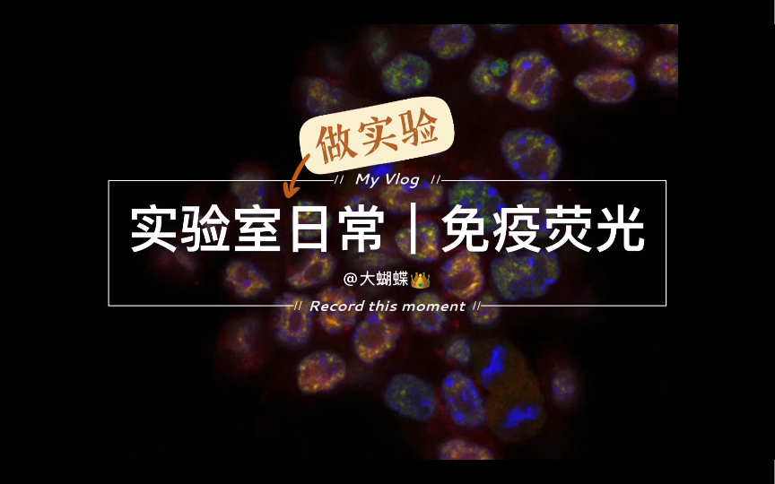 Immunofluorescence IF Protocol and Confocal Imaging