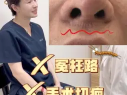 Download Video: 人中缩短疤痕 ，快来看看他走过哪些弯路