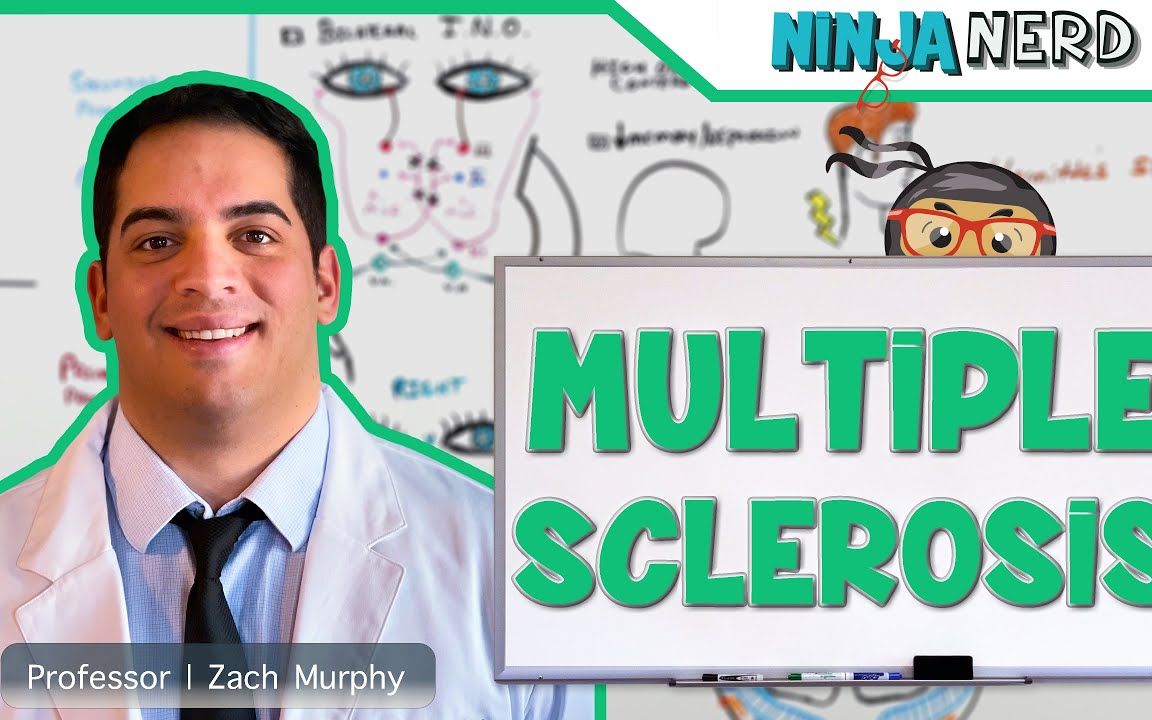 多发性硬化症 | 病因学、病理生理学、MS 类型、临床特征、诊断、治疗哔哩哔哩bilibili