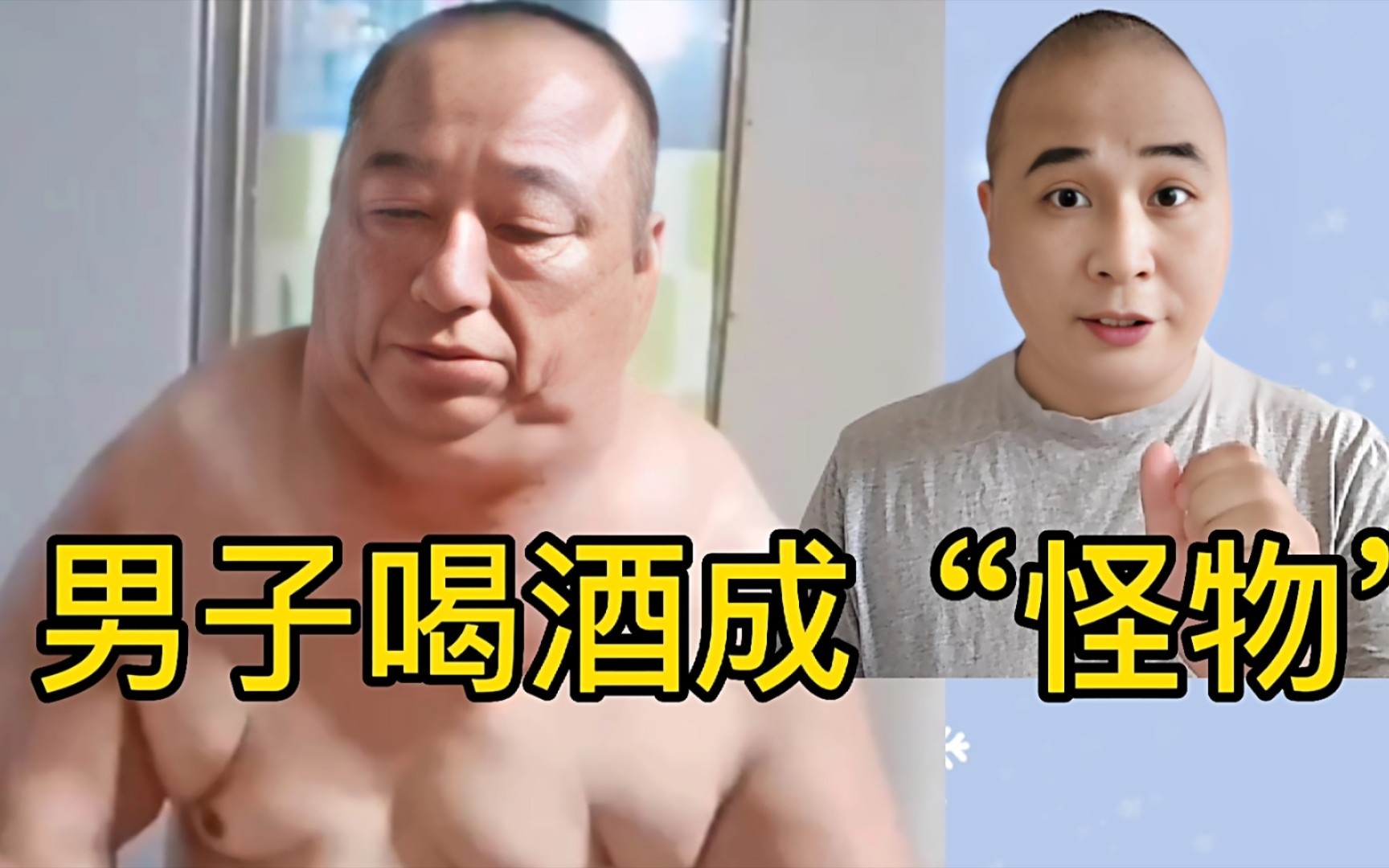 [图]男子因过度饮酒脖子粗如牛，小朋友都被吓哭了，喝酒比抽烟更伤身