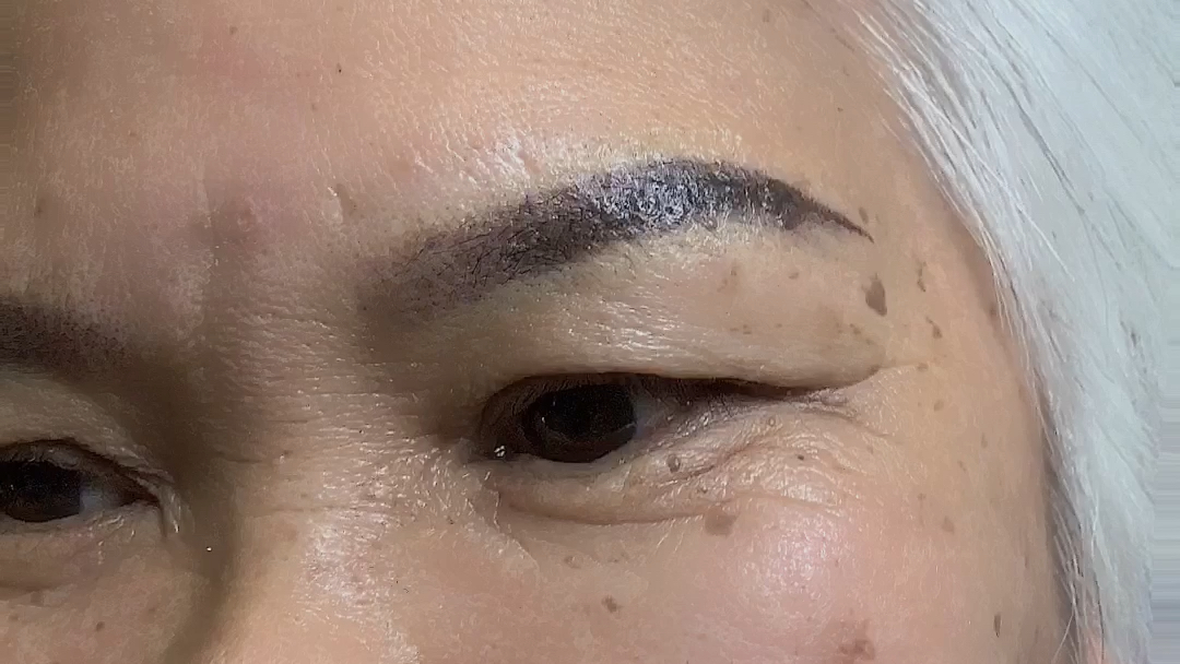 今日客照之下垂眉毛重塑