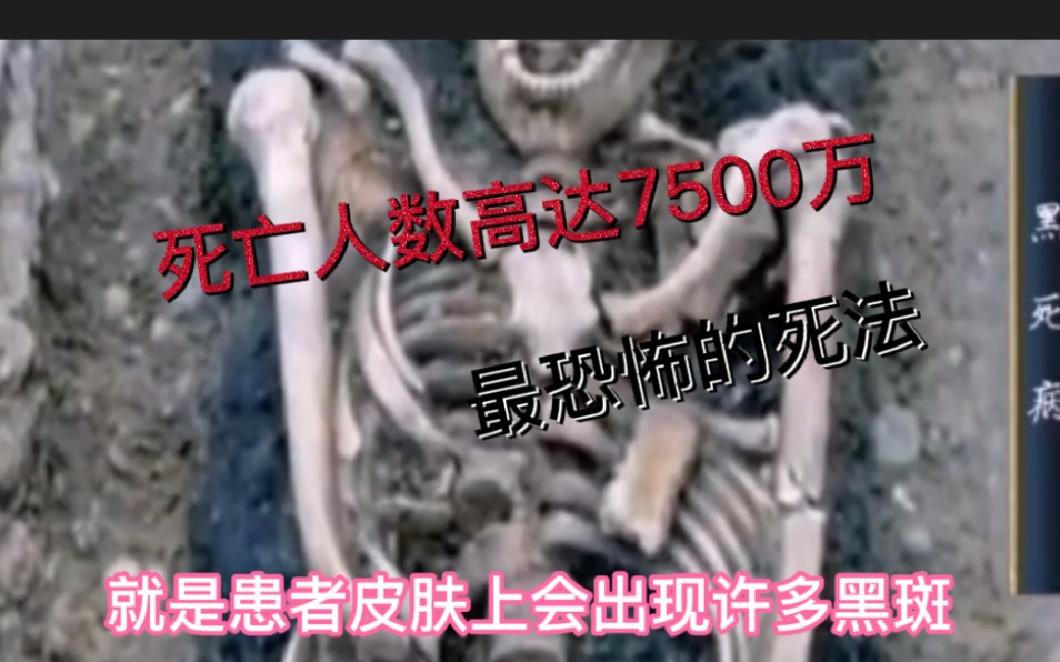 史上最恐怖的瘟疫之一 黑死病死亡人数高达7500万 最恐怖的死法哔哩哔哩bilibili