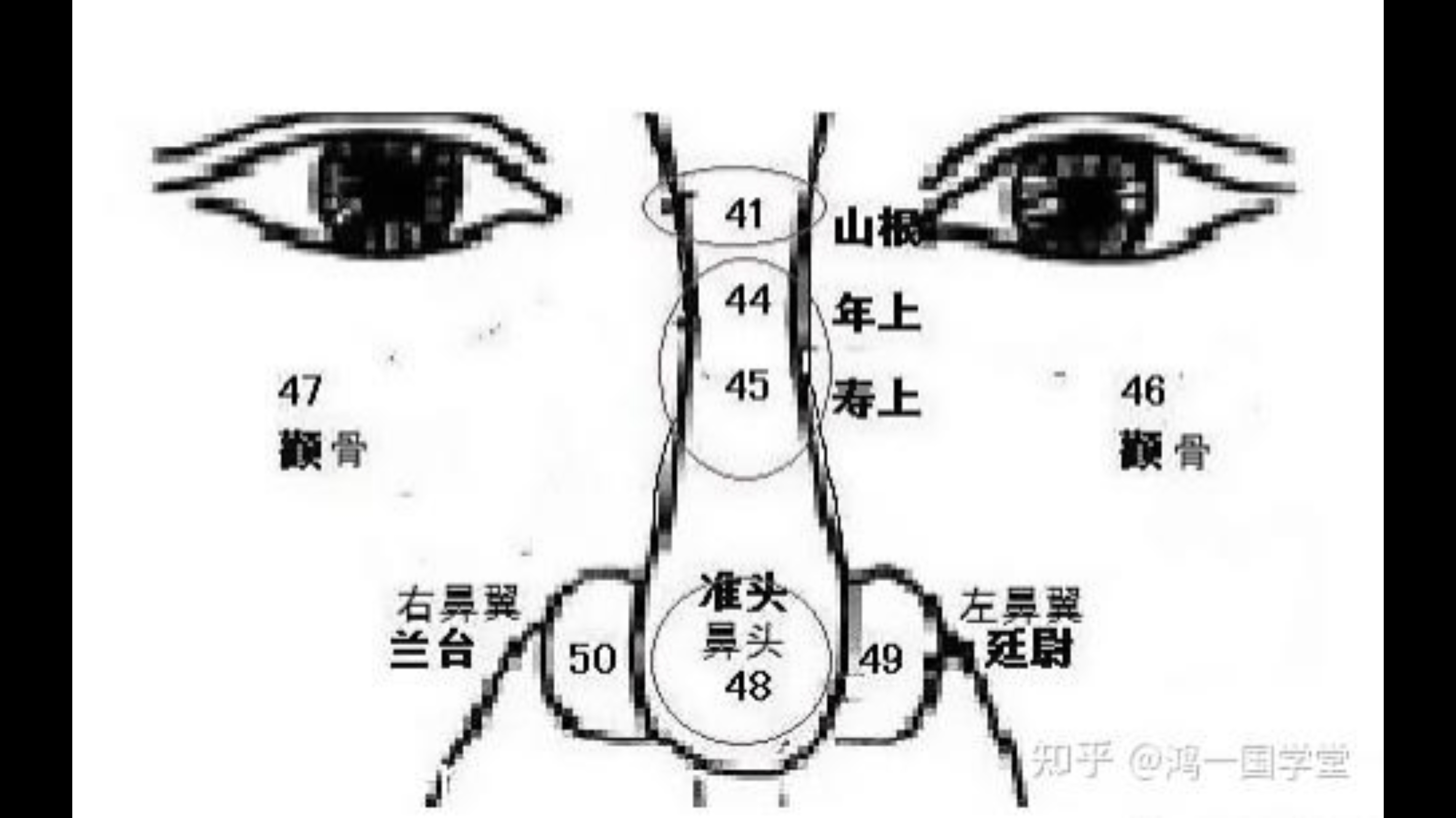 鼻子上有肉痣图解图片