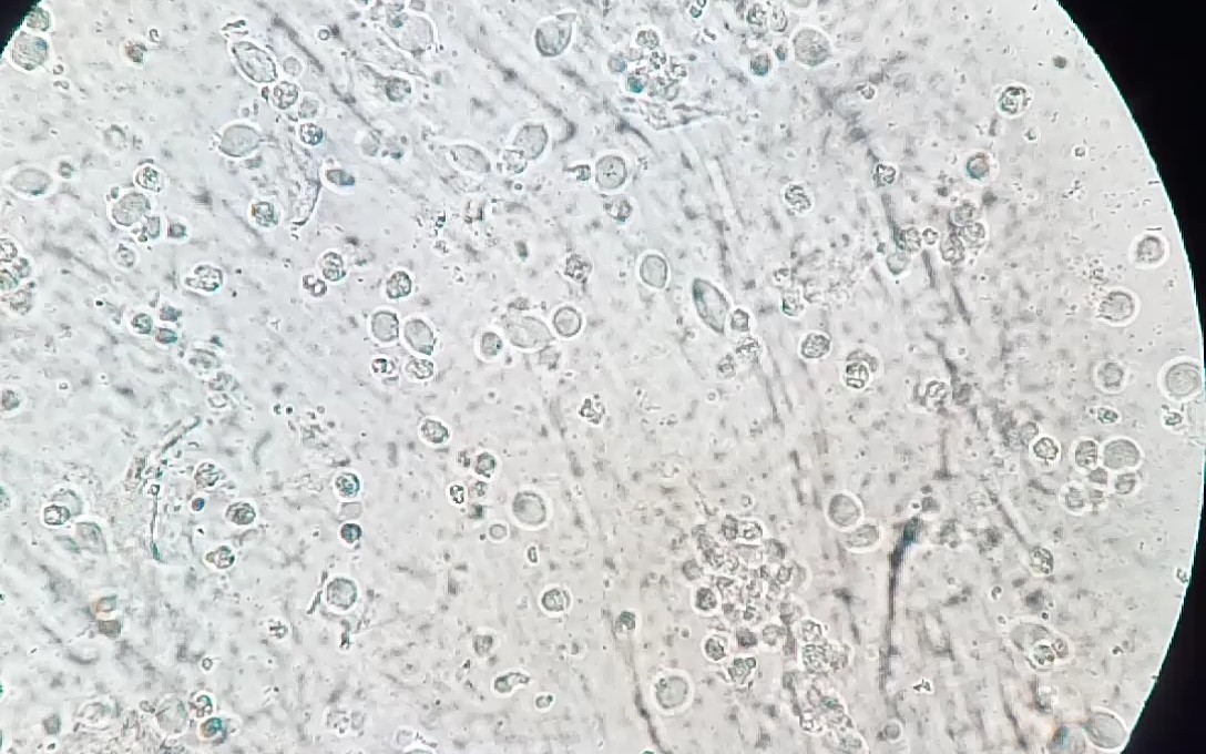 滴虫显微镜下图片