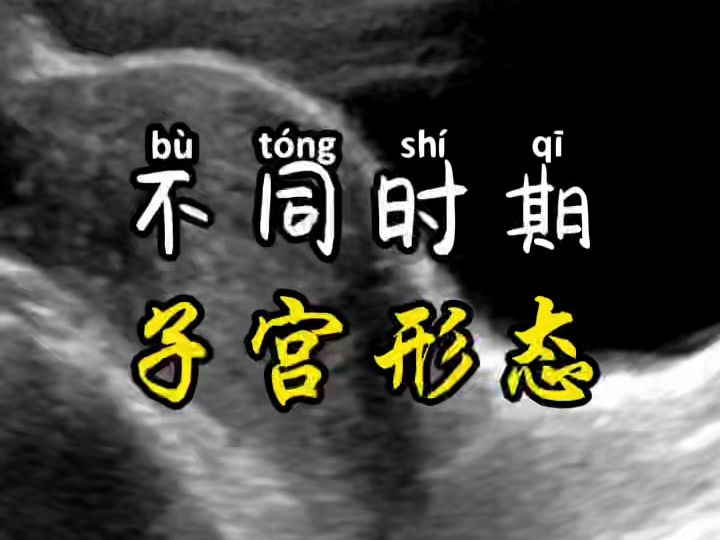 不同年龄子宫的形态哔哩哔哩bilibili