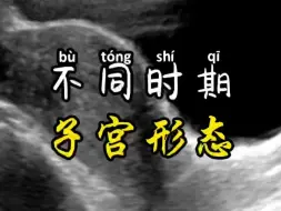 Video herunterladen: 不同年龄子宫的形态