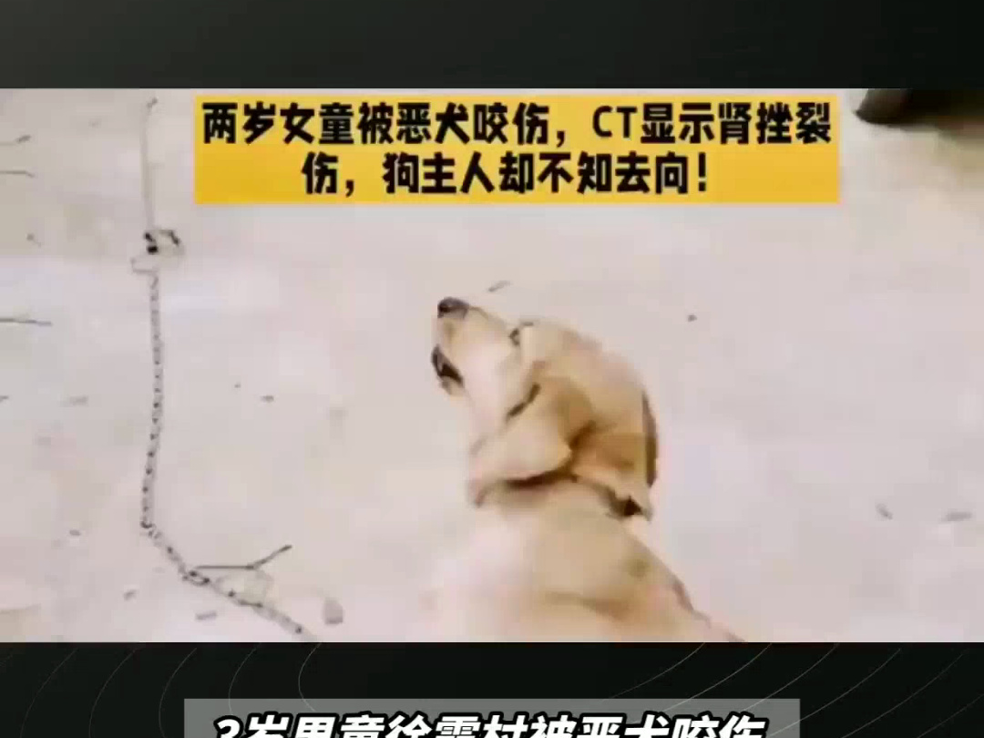 3岁男童被藏獒咬伤