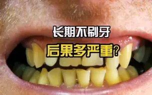 Tải video: 不刷牙，后果很严重