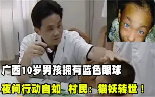 Tải video: 广西10岁男孩拥有蓝色眼球，夜间也活动自如，村民：猫妖转世！