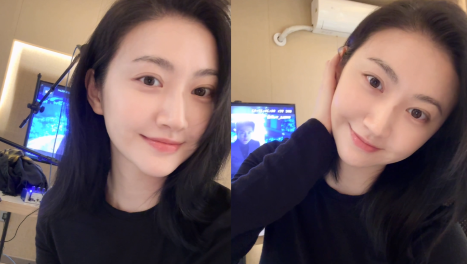 景甜手术后复工状态曝光,气色红润笑容甜美,腿上仍戴着护具