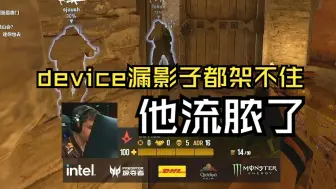 Download Video: 莱昂凯看傻device漏影子都架不住枪：我只能说他流脓了！回合结束立马打开玩机器直播间！