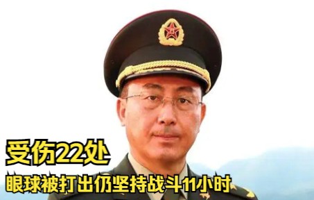 [图]全身受伤22处，左眼被打出来扔坚持战斗11小时，战斗英雄韦昌进