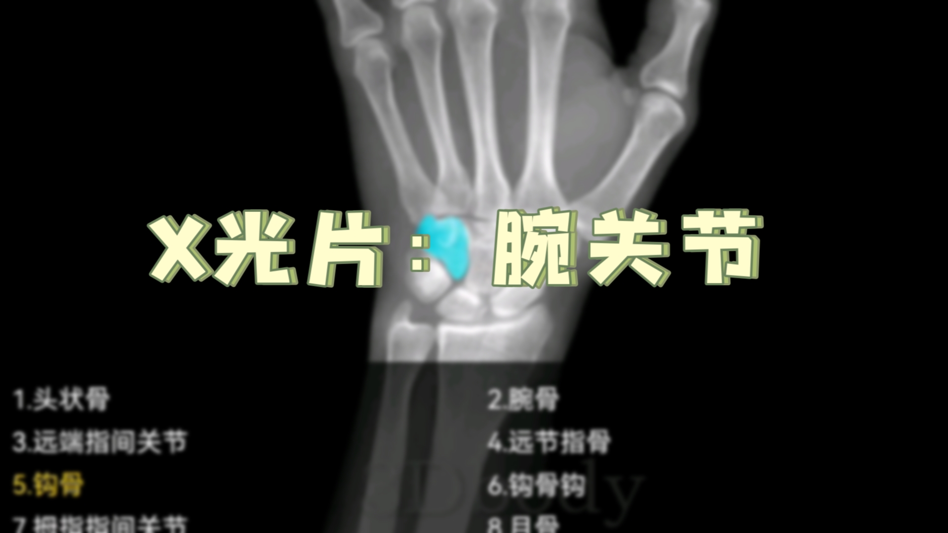 X光片:腕关节(成人)哔哩哔哩bilibili