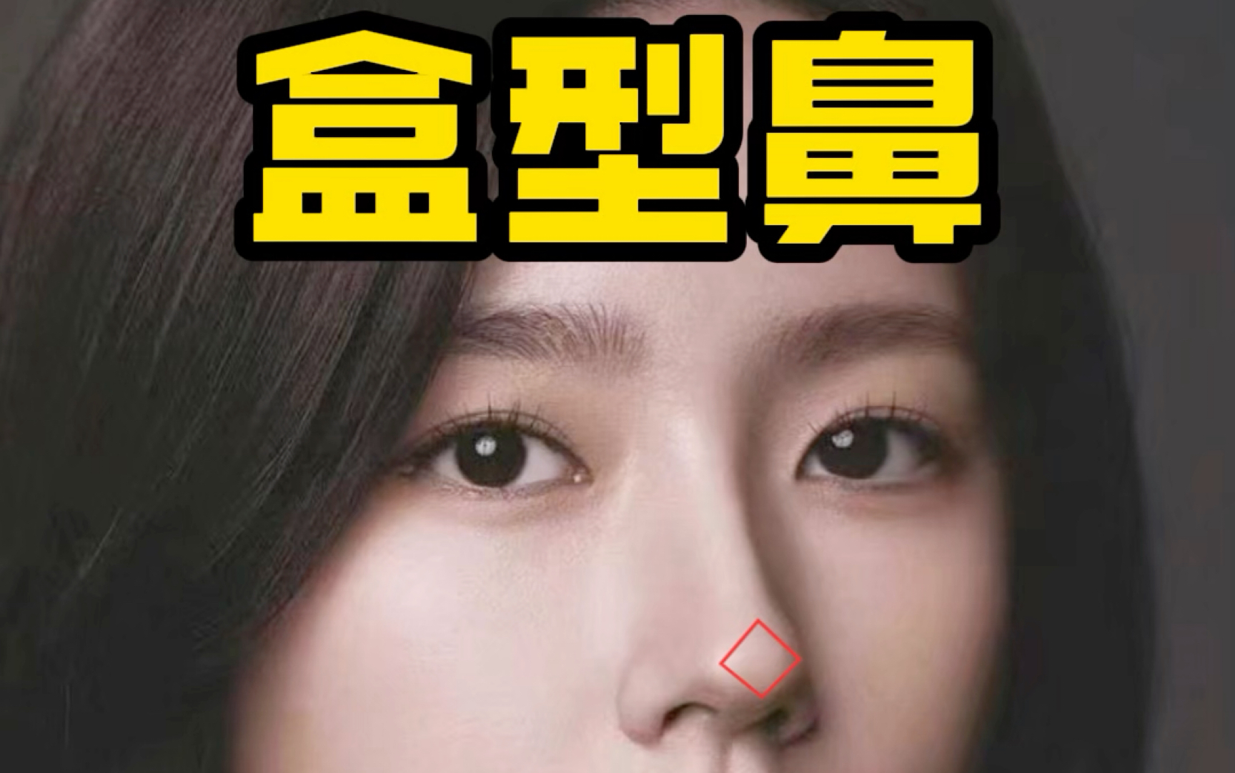 盒型鼻#鼻子#鼻整形