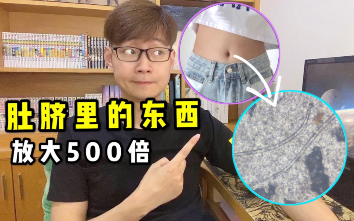 肚脐里的东西能抠吗?放大500倍看见类似虫子的东西!