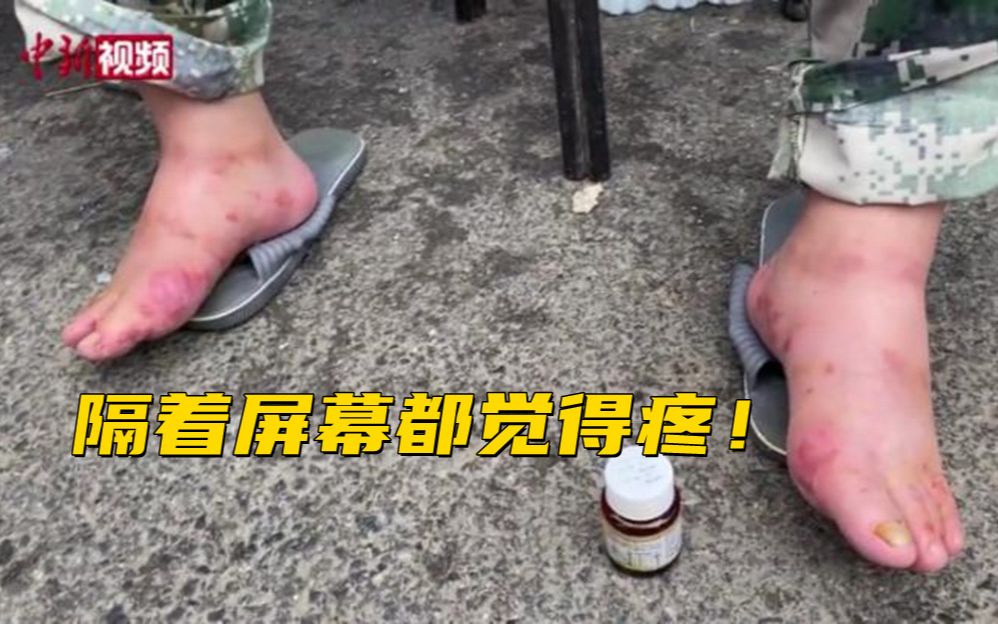 泪目!河南新乡这位前线救援指挥的脚让人心疼哔哩哔哩bilibili