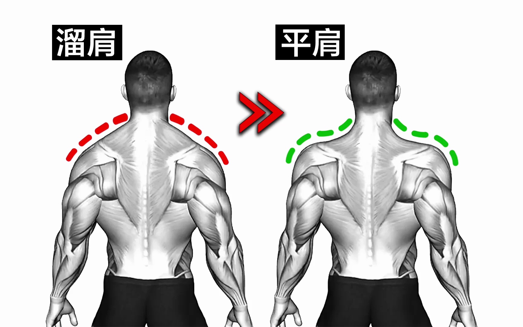 5个动作直接改善溜肩,把溜肩变成直角肩哔哩哔哩bilibili