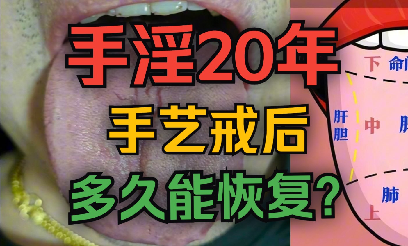 [图]手淫整整20年，手艺戒后，身体多久能恢复？【戒色必看】