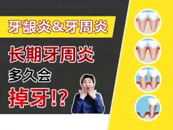 Download Video: 牙龈炎VS牙周炎丨牙周炎真的是“不治之症”吗？到底谁才是掉牙的“罪魁祸首”！