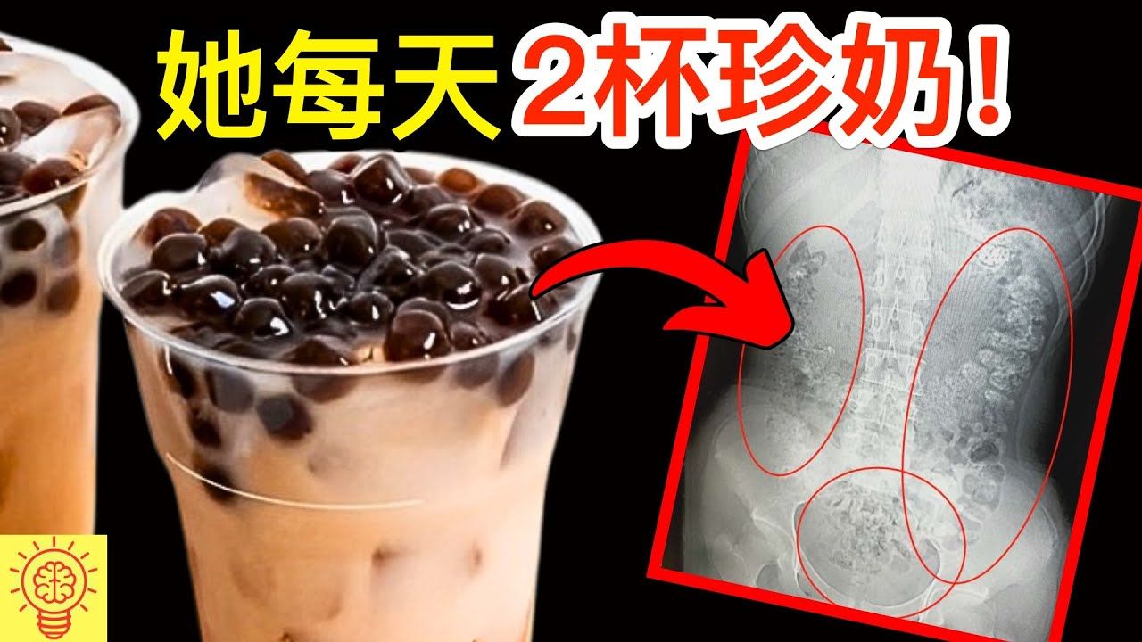 她每天喝两杯珍珠奶茶 结果身体发生惊人变化 连医生都看傻眼