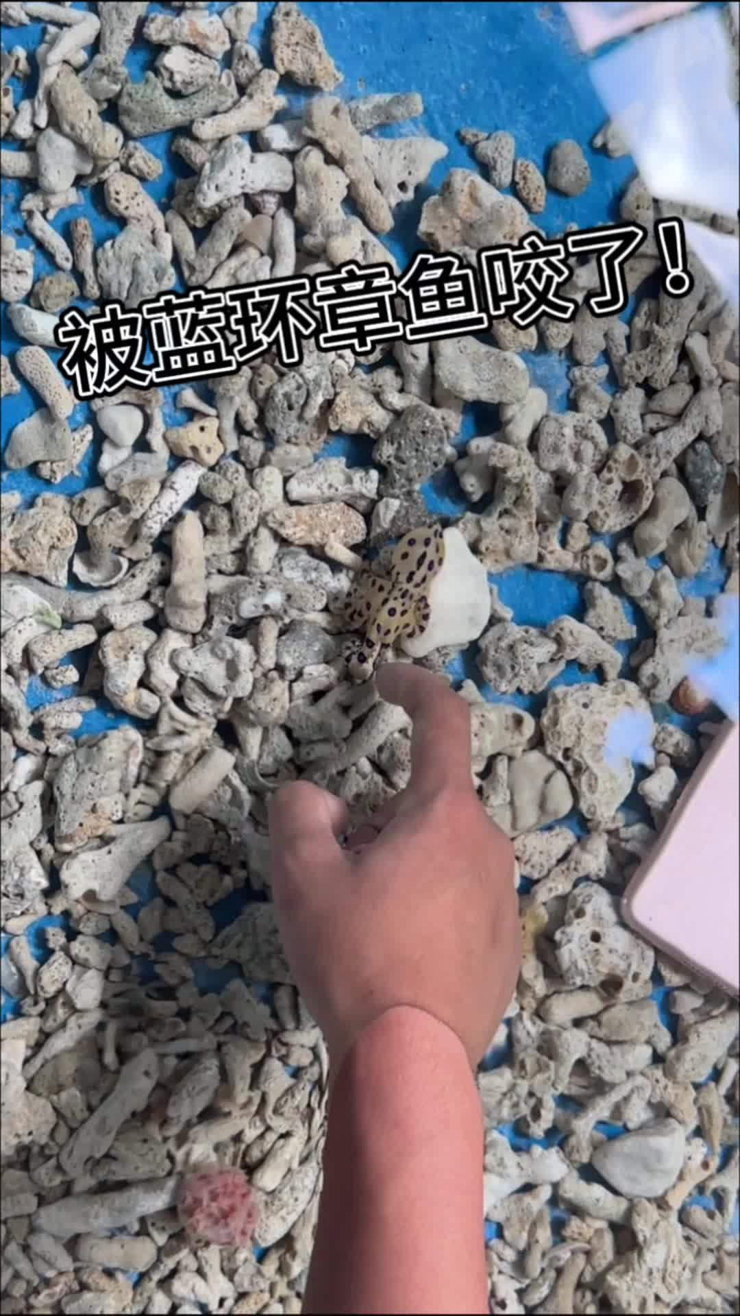 被藍環章魚咬了,在線等怎麼辦!