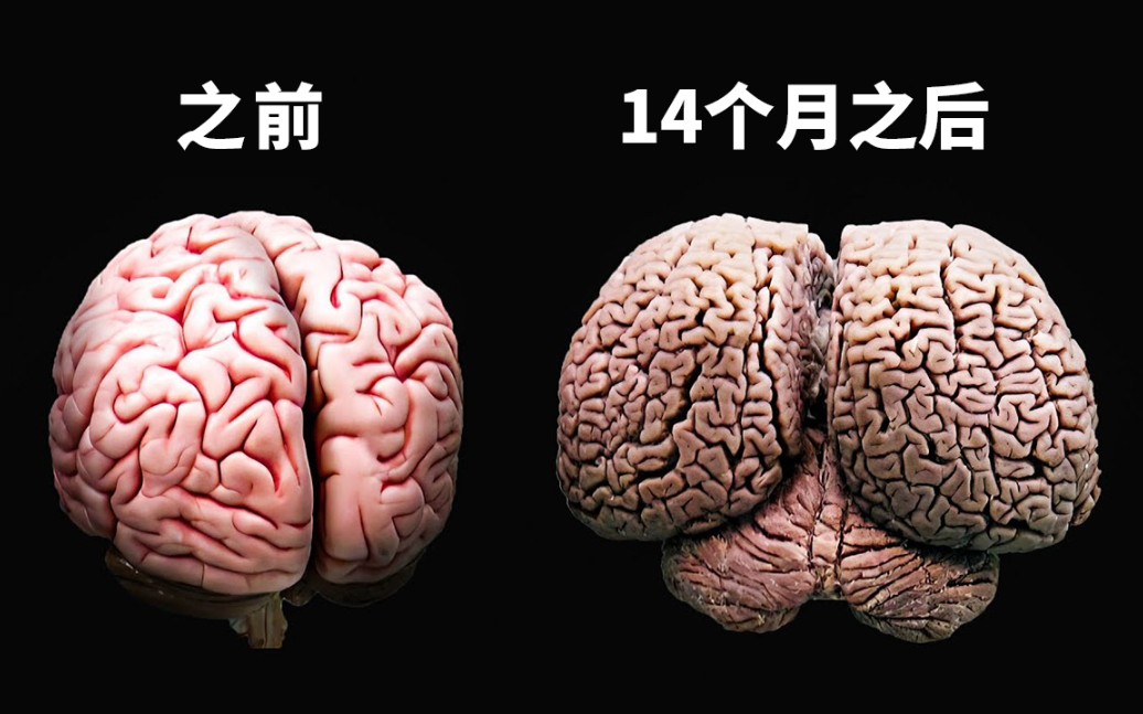 [图]【科普】科学家们在南极洲呆了14个月，他们的大脑变这样了