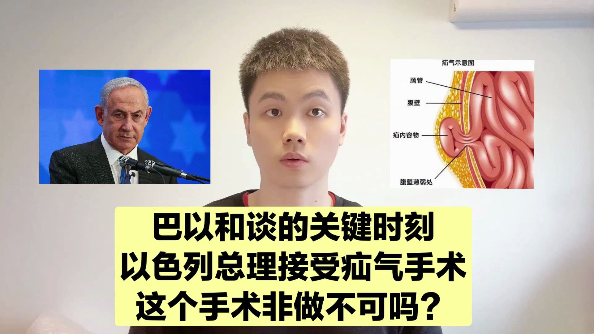 疝气是什么病,一定要做手术吗?手术风险大不大?曾医生告诉你!哔哩哔哩bilibili