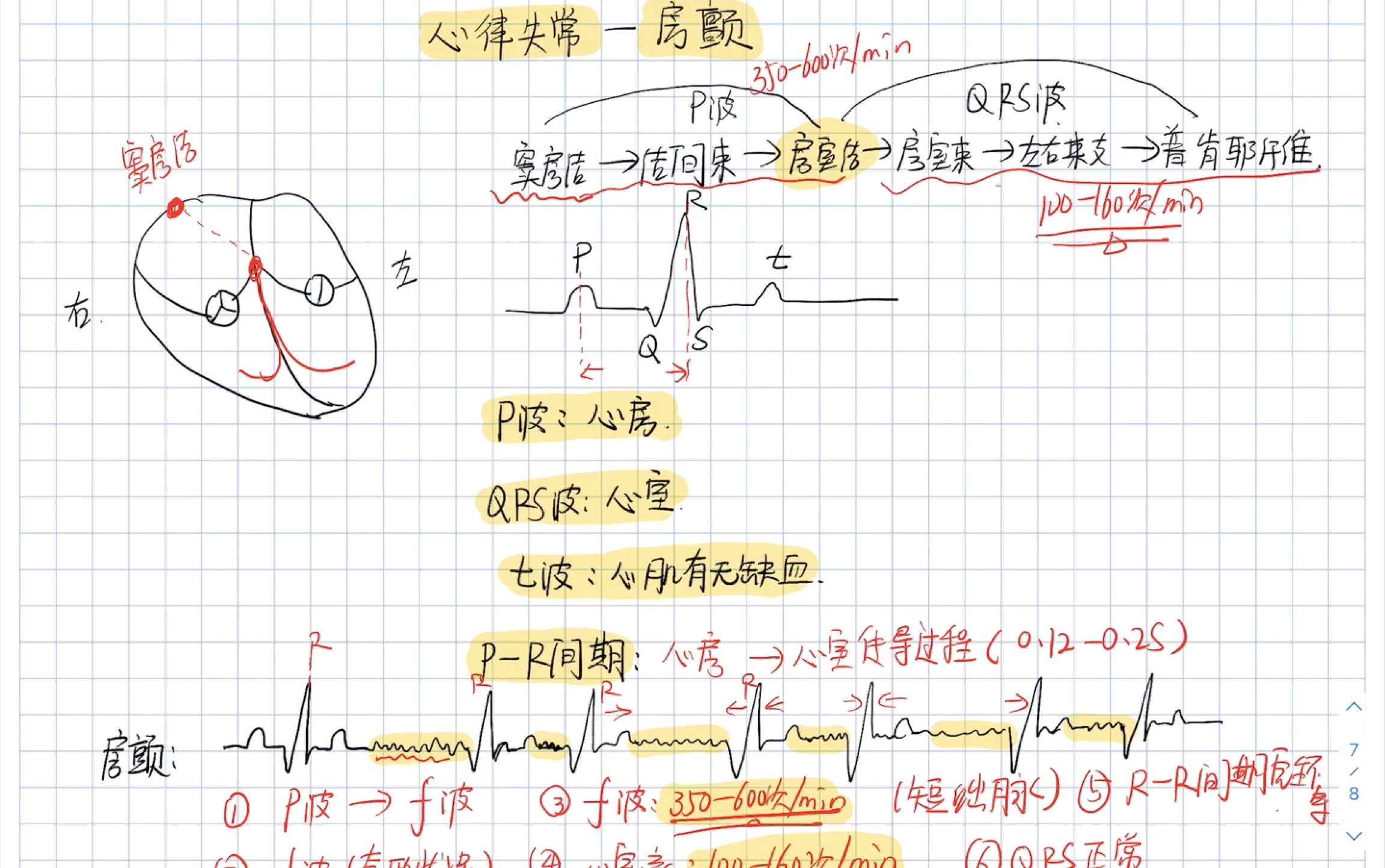 [图]内科护理学～房颤